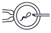 Intracytoplasmic sperm injection (ICSI)
